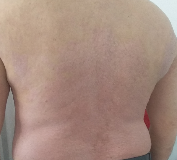Correct back After